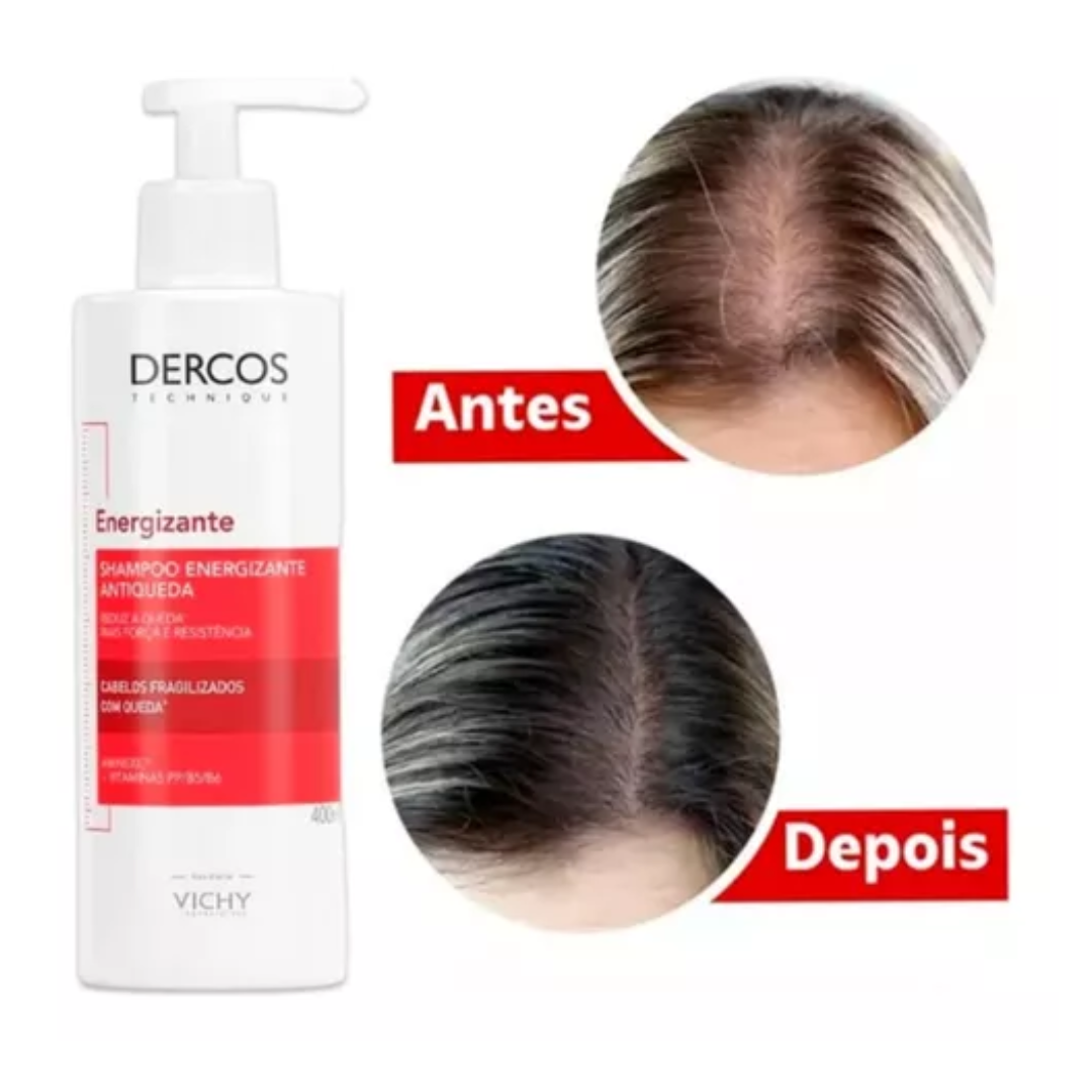 Vichy Dercos Coffret Complet – Shampooing, Après-Shampooing, Super Ampoule & Sérum
